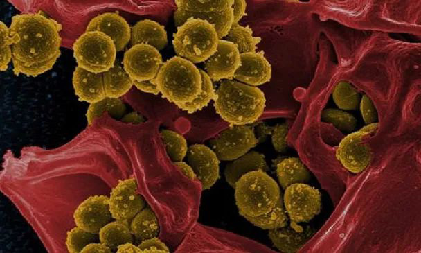 ѩ��������ù����ʲô����ʲôҪʹ�ÿ�����ù����